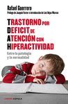 TRASTORNO POR DEFICIT DE ATENCION CON HIPERACTIVID