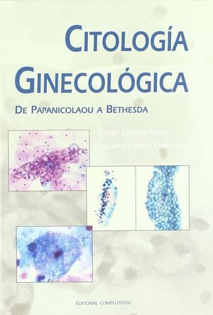 CITOLOGÍA GINECOLÓGICA DE PAPANICOLAOU A BETHESDA