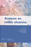 AVANCES EN COLITIS ULCEROSA